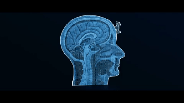 自杀式无人机攻击方式